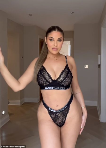 Anna Vakili of Love Island flaunts her recent surgery results, donning a lace bra to reveal corrected breast implants in Turkey