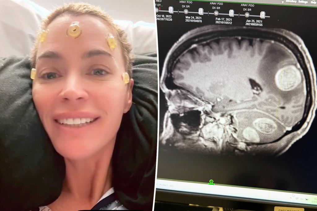 rewrite this title
Teddi Mellencamp reveals ‘more tumors’ were removed from brain than originally expected: ‘This fight is not over’